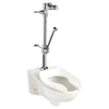 American Standard Ultima Manual Flush Valve With Bedpan Washer Assembly, Straight Tube, 1.28 gpf/4.8 Lpf